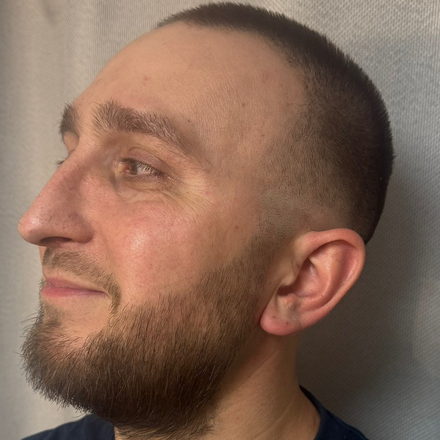 Стрижка под насадку