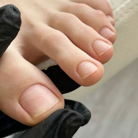 педикюр пальчики без покрытия