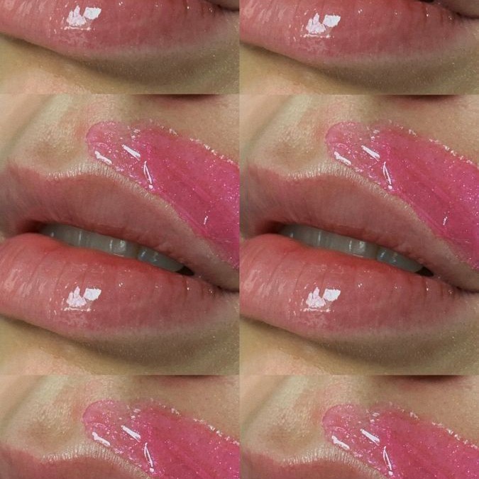 Верхняя губа