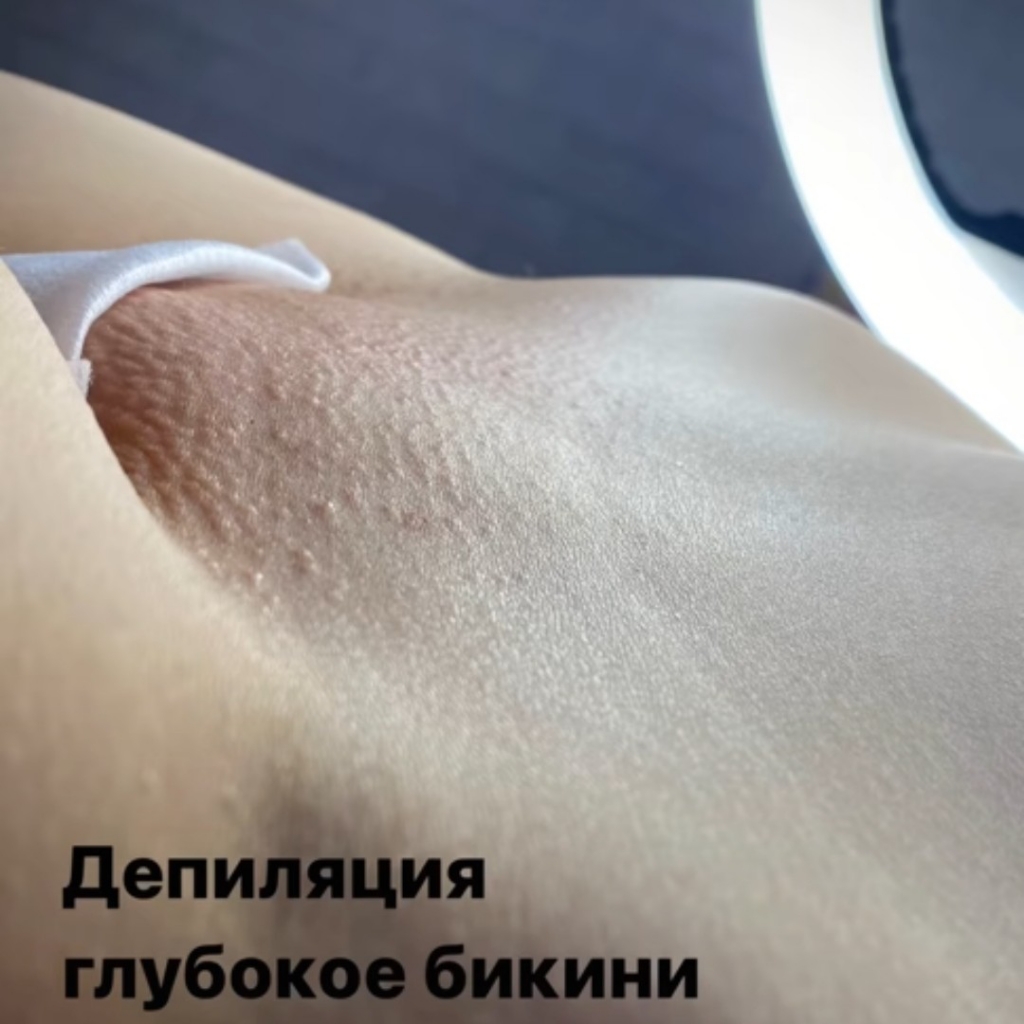 Глубокое бикини