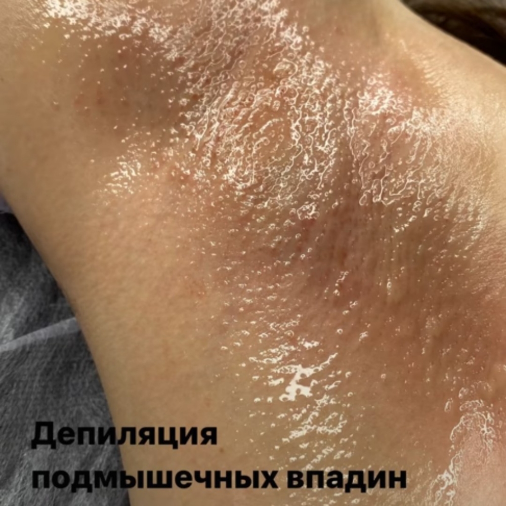 Подмышечные впадины