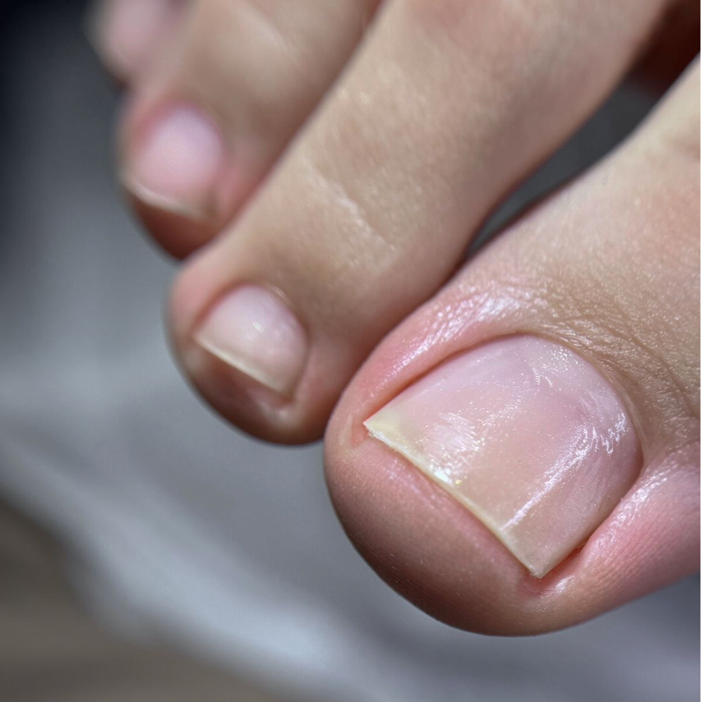 Педикюр пальчики