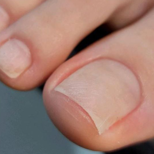 Комплекс M (Smart-педикюр, без покрытия)