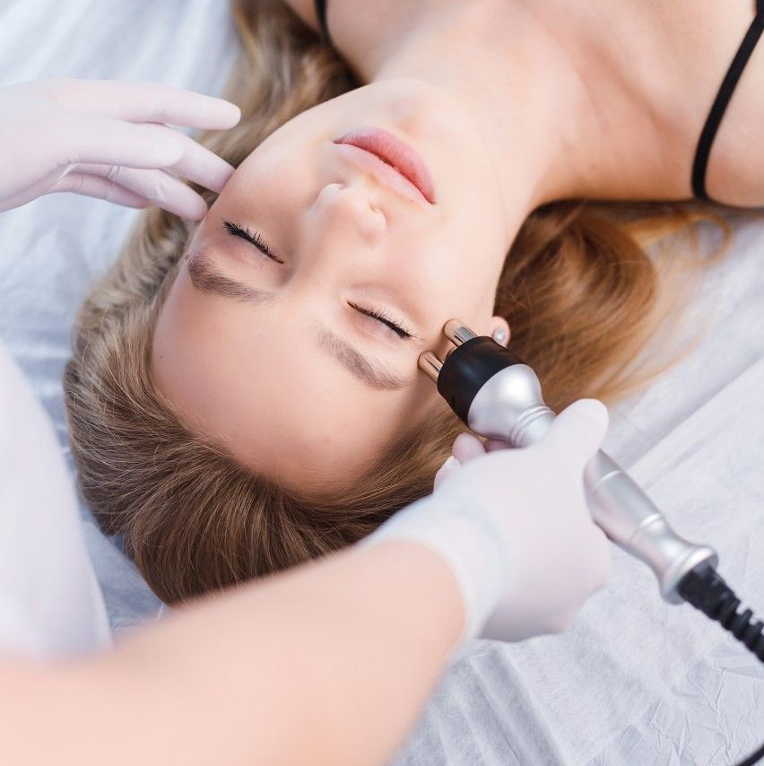 Rf лифтинг лица