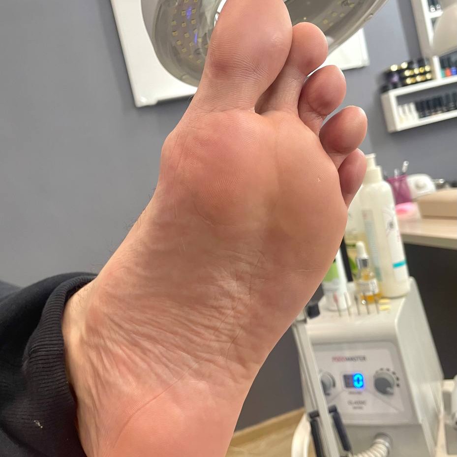 Педикюр мужской