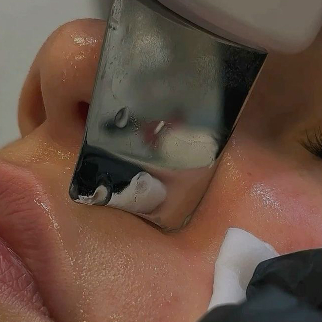 Чистка лица