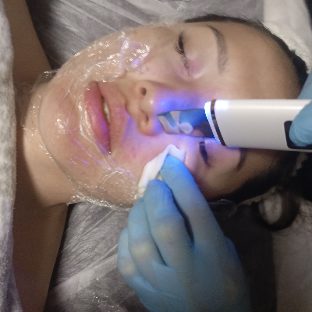 Уз чистка лица