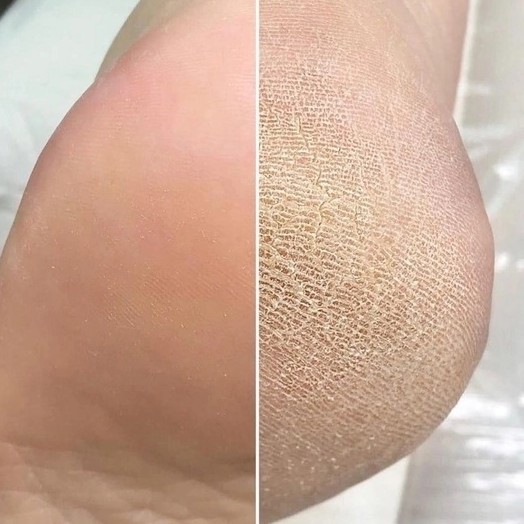 Педикюр аппаратный ( без обработки стоп)