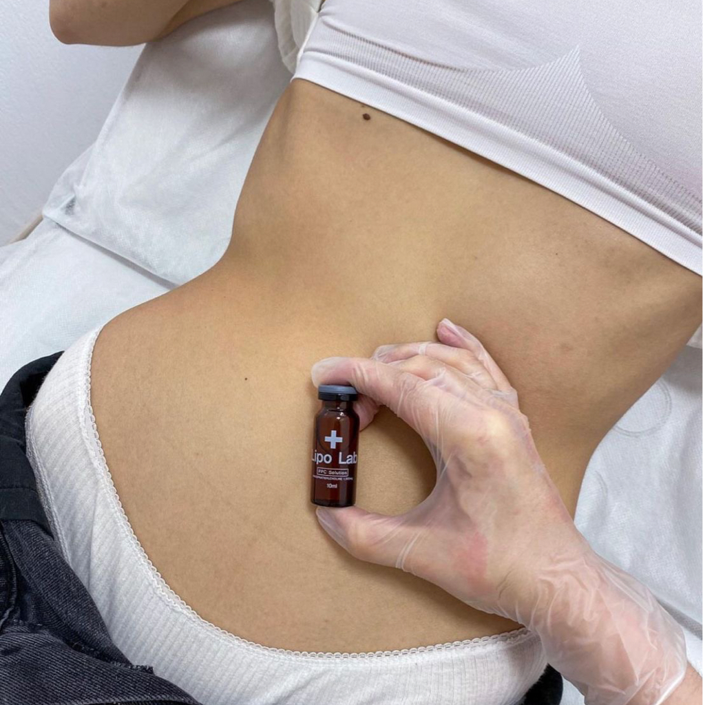 Липолитики по телу