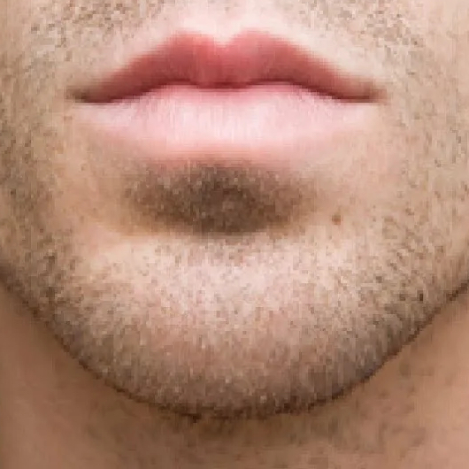 Подбородок