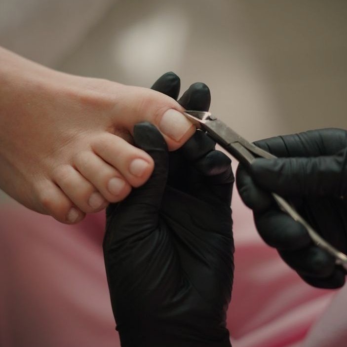 11. ЗАЧИСТКА ОНИХОЛИЗИСА (БЕЗ ПЕДИКЮРА)