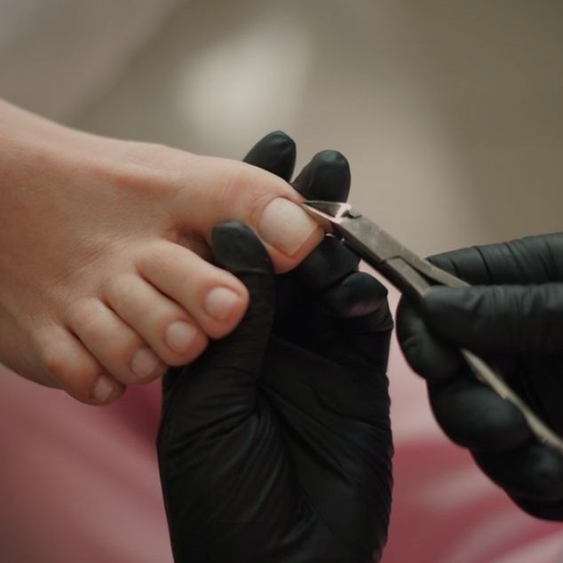 10. УДАЛЕНИЕ НАТОПТЫШЕЙ/СУХИХ МОЗОЛЕЙ/СТЕРЖНЕВЫХ МОЗОЛЕЙ 1 СТОПА