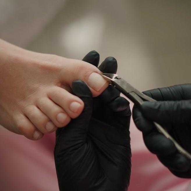 10. ГРИБКОВОЕ ПОРАЖЕНИЕ (БЕЗ ПЕДИКЮРА) 1-3 НОГТЯ