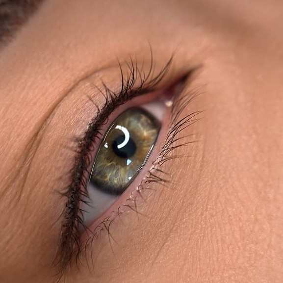 КОРРЕКЦИЯ: МЕЖРЕСНИЧКА