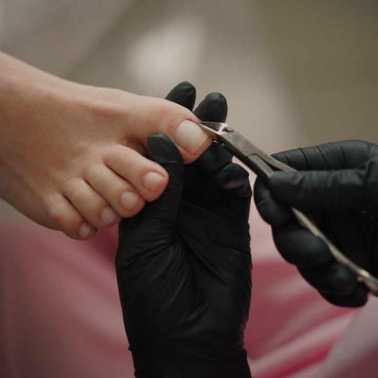 12.ГРИБКОВОЕ ПОРАЖЕНИЕ (БЕЗ ПЕДИКЮРА) 1-3 НОГТЯ