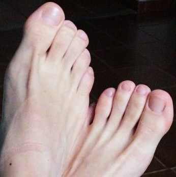 Пальцы ног