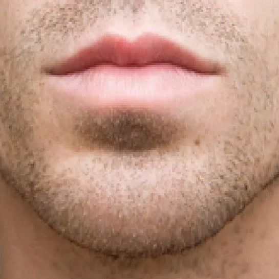 Подбородок