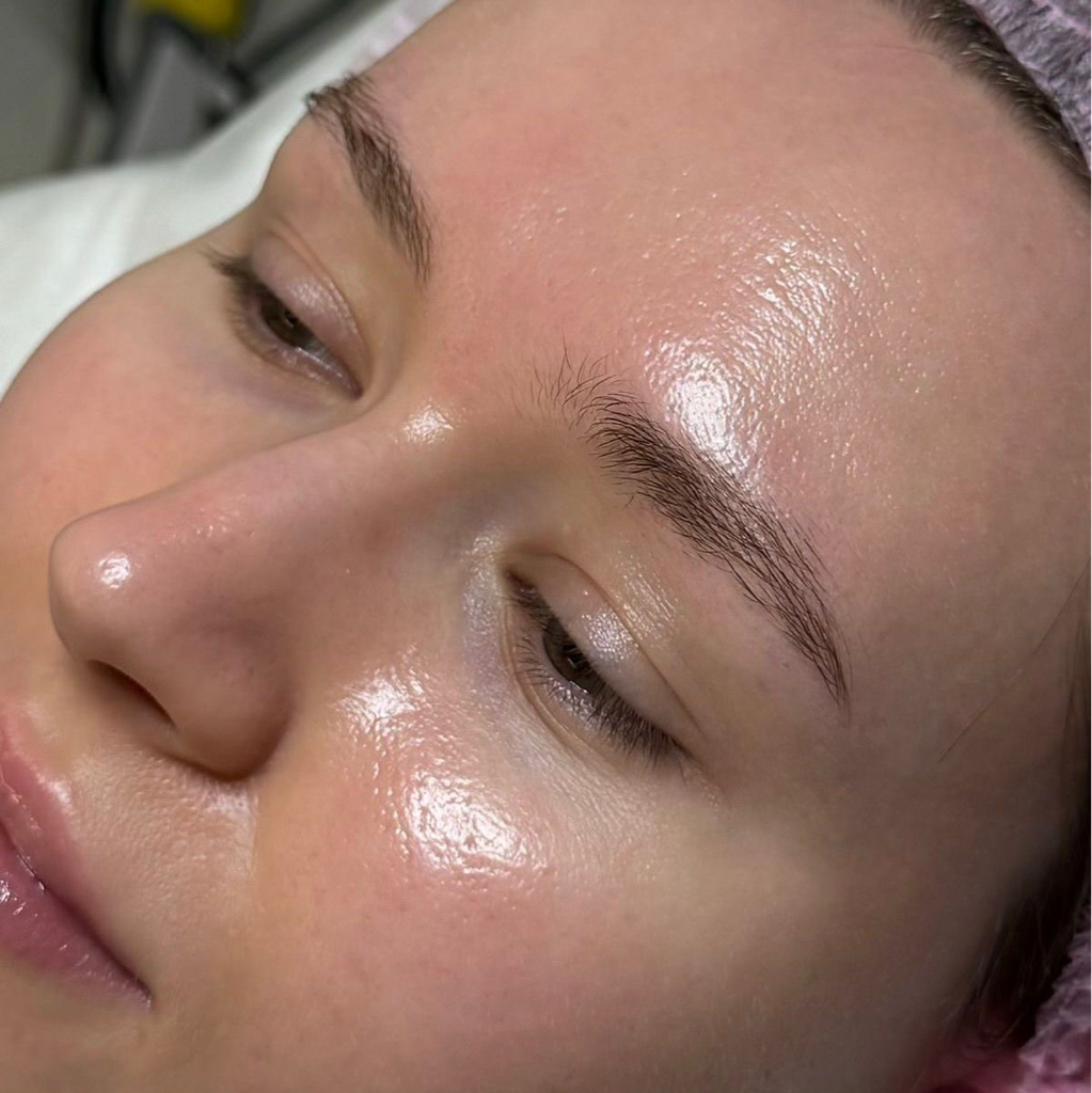 Всесезонный пилинг (миндальная, лактобионовая, глюконолактон)