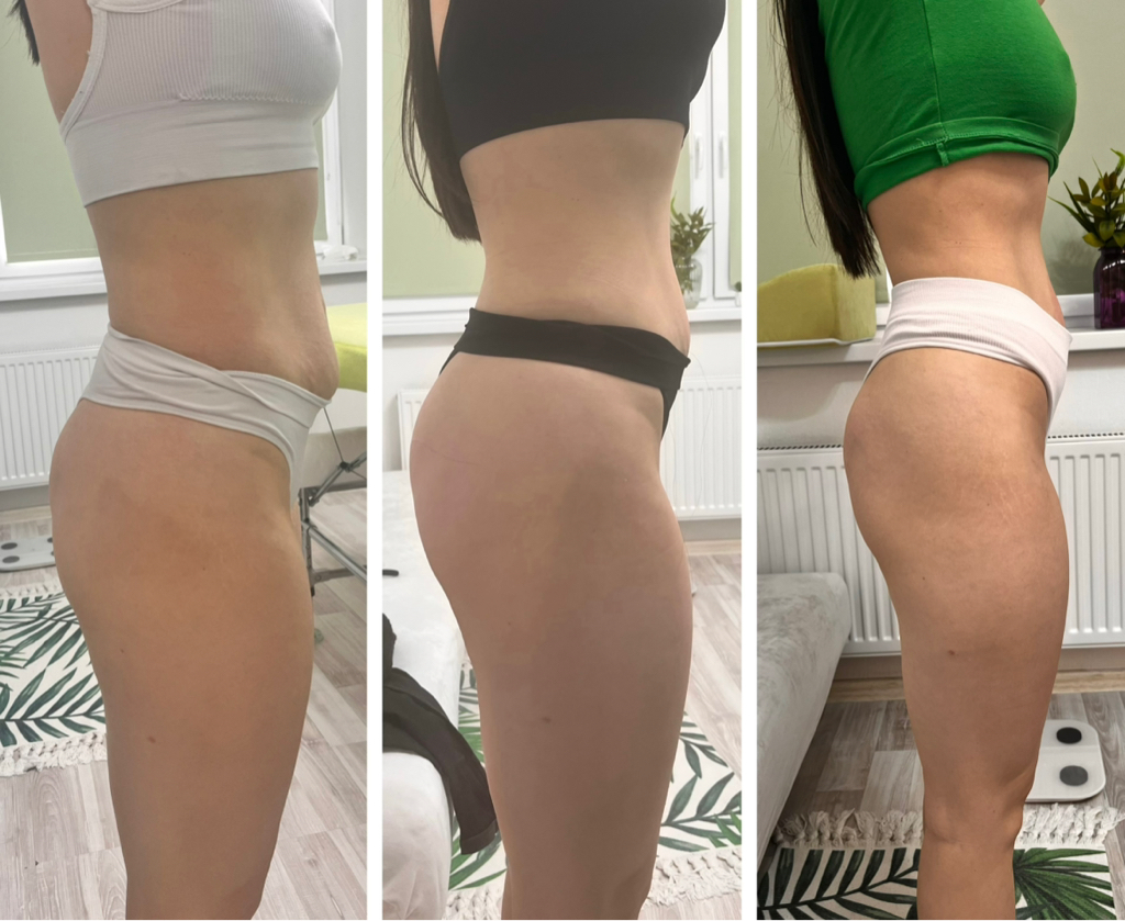 Программа ИНТЕНСИВ скидка 30%