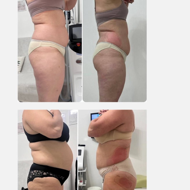 Комплекс для тела 1