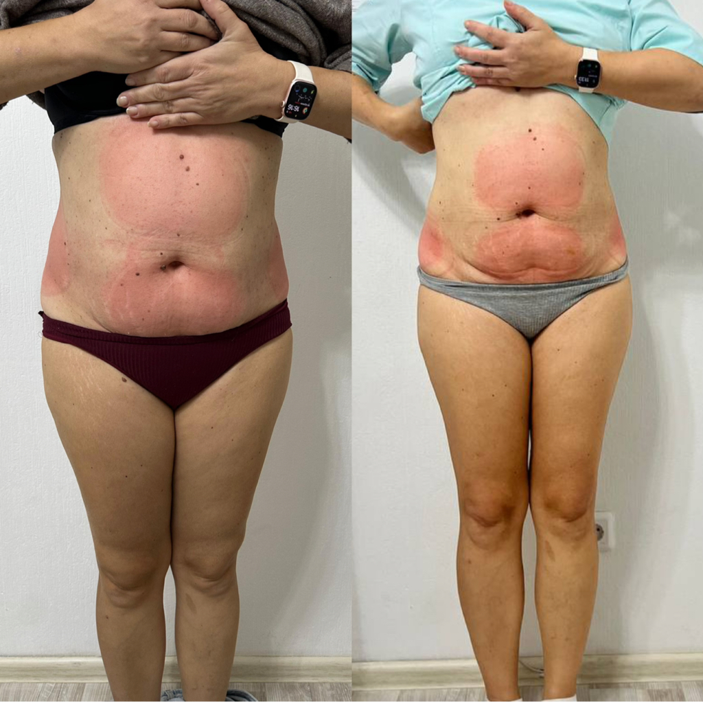 Комплекс для тела 3