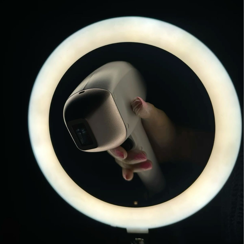 бакенбарды александритовый лазер Candela