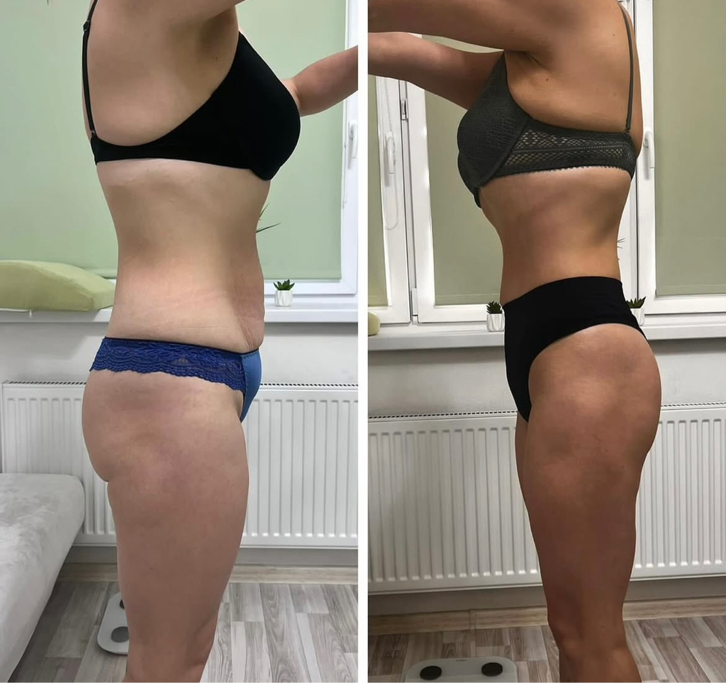 Программа СОВЕРШЕННОЕ ТЕЛО скидка 35%