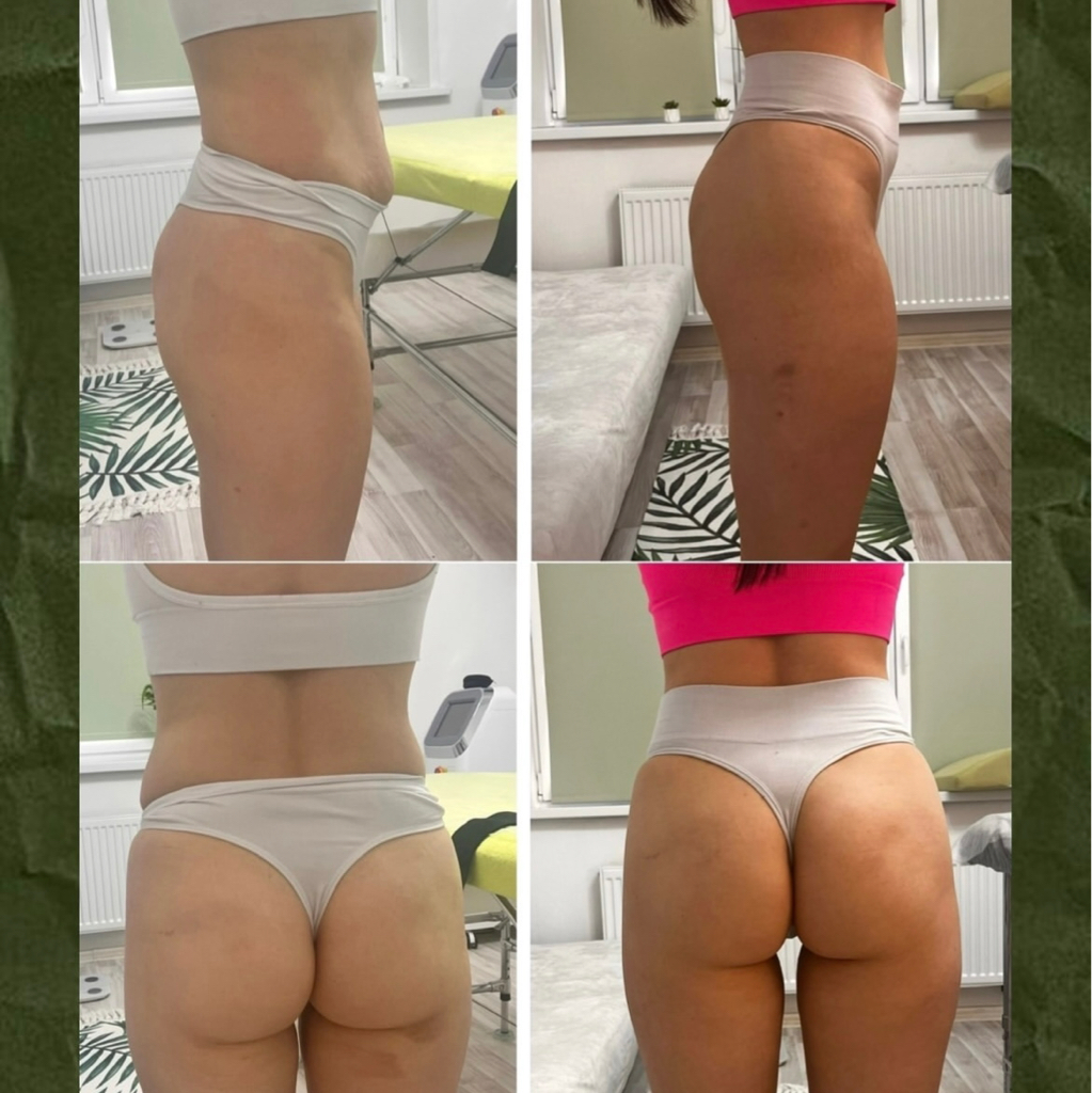 Программа ЭКСПРЕСС ПРЕОБРАЖЕНИЕ скидка 15%