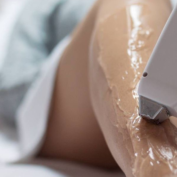 голени (включая колени) александритовый лазер Candela