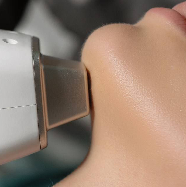 шея александритовый лазер Candela