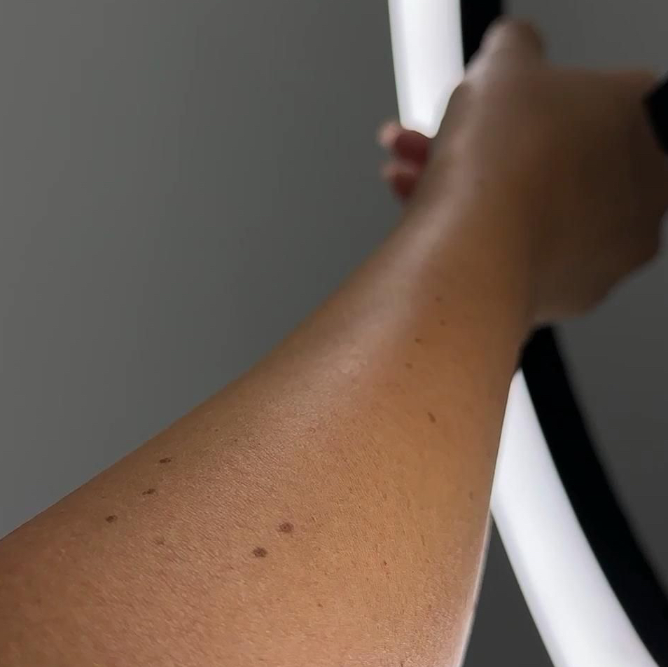 руки полностью александритовый лазер Candela