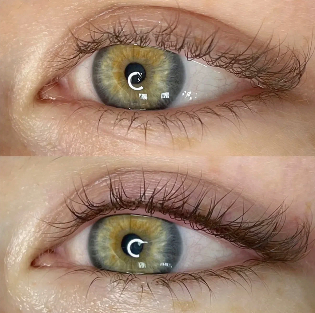 Меж ресничка