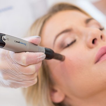 АКЦИЯ!Фракционная (dermapen) мезотерапия кожи лица / кожи головы - 2790 рублей вместо 3790 (только до 28 февраля)