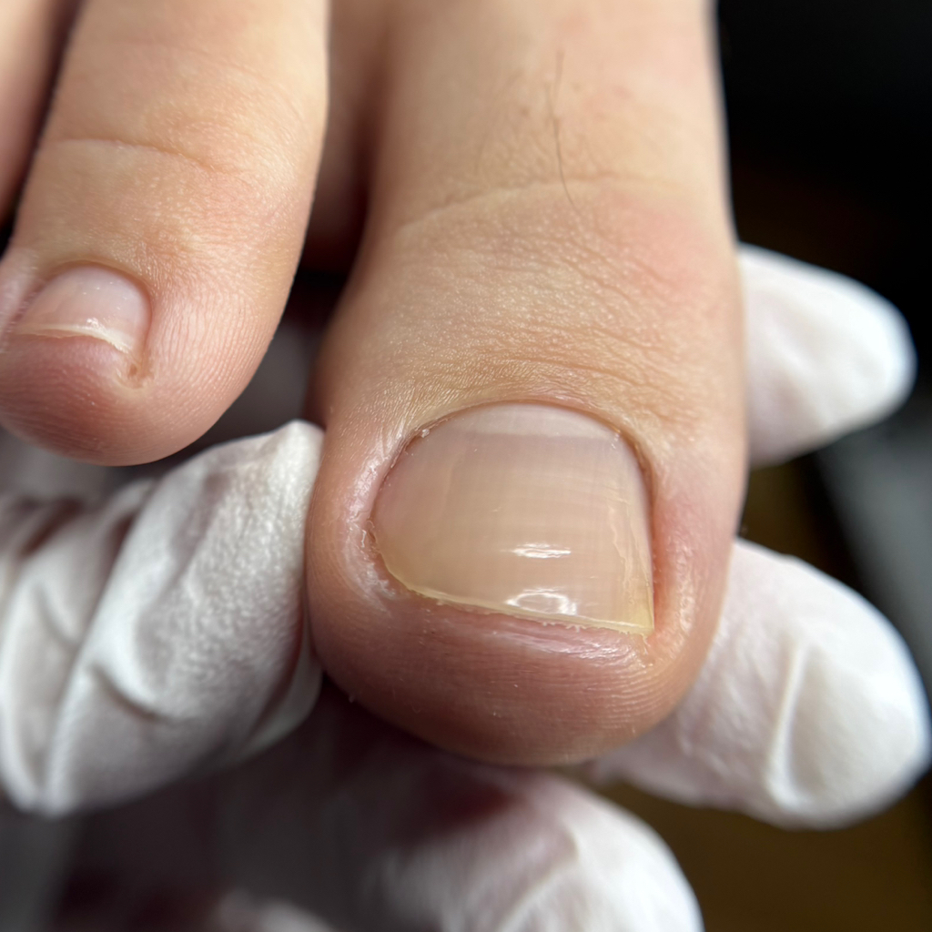 Снятие коррекционной системы