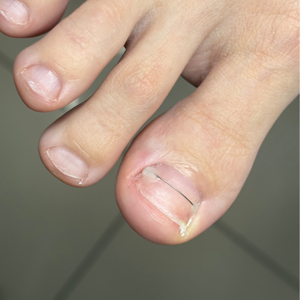 Установка коррекционной системы