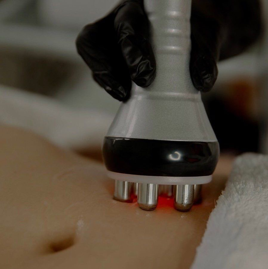 RF лифтинг- 55 минут