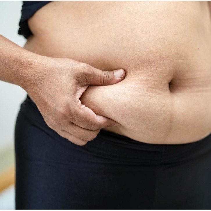 Консультация