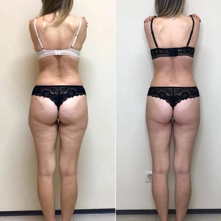 Массаж  "Турбо" всего тела