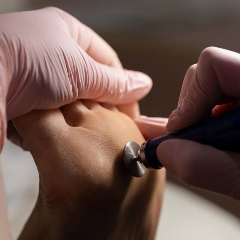 Эстетический педикюр с предварительным снятием покрытия + обработка стоп и пальчиков