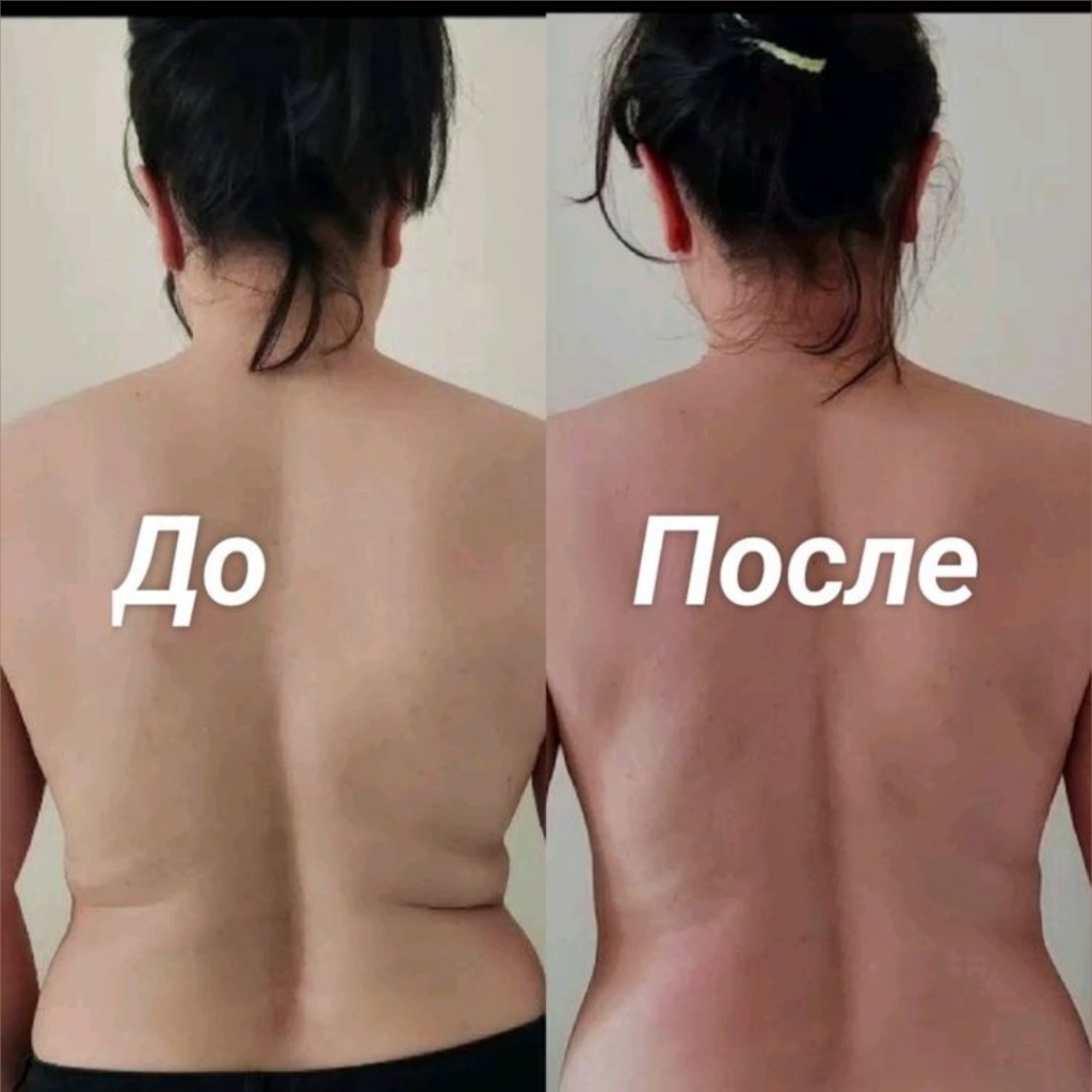 Массаж спины