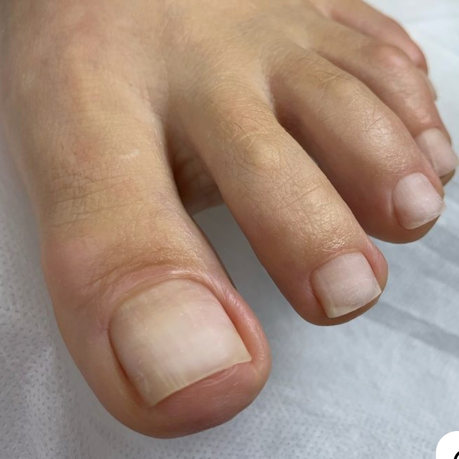 Мужской педикюр,  обработка пальчиков без покрытия