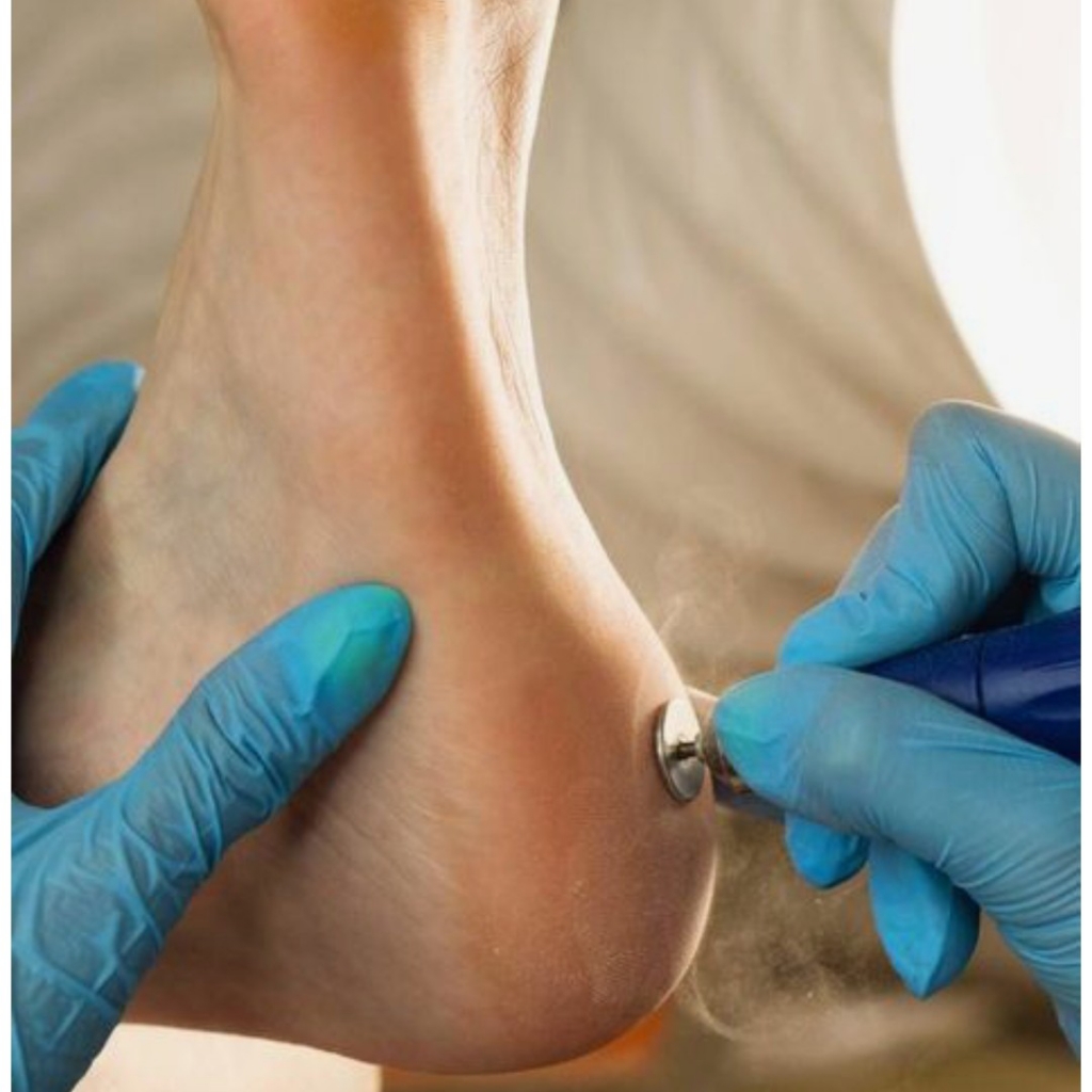 Мужской педикюр с обработкой стоп без покрытия