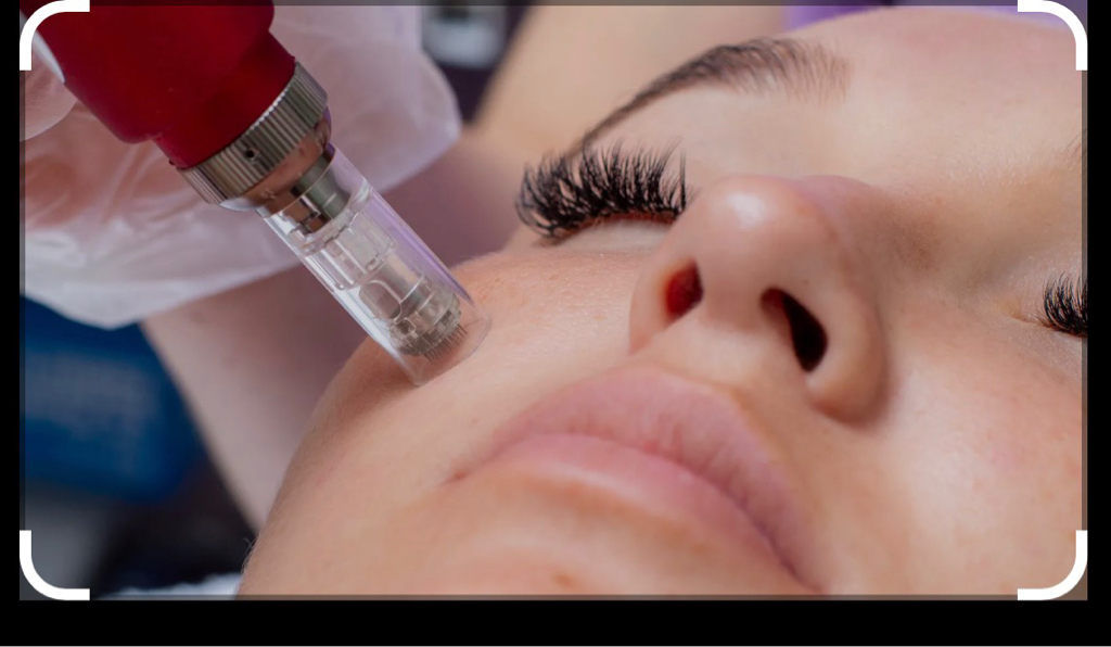 микронидлинг