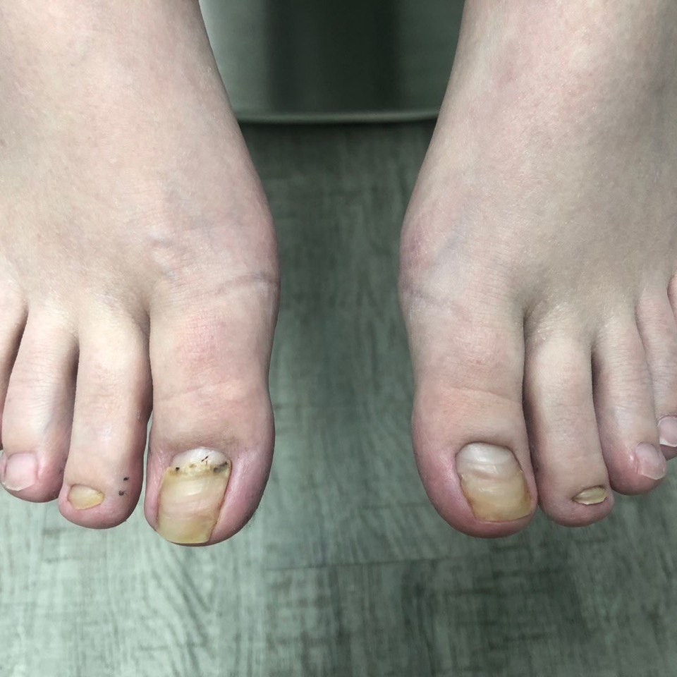 комплексная обработка стоп и ногтей 2 категории