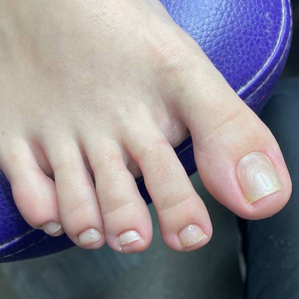 Снятие, педикюр (пальчики), покрытие