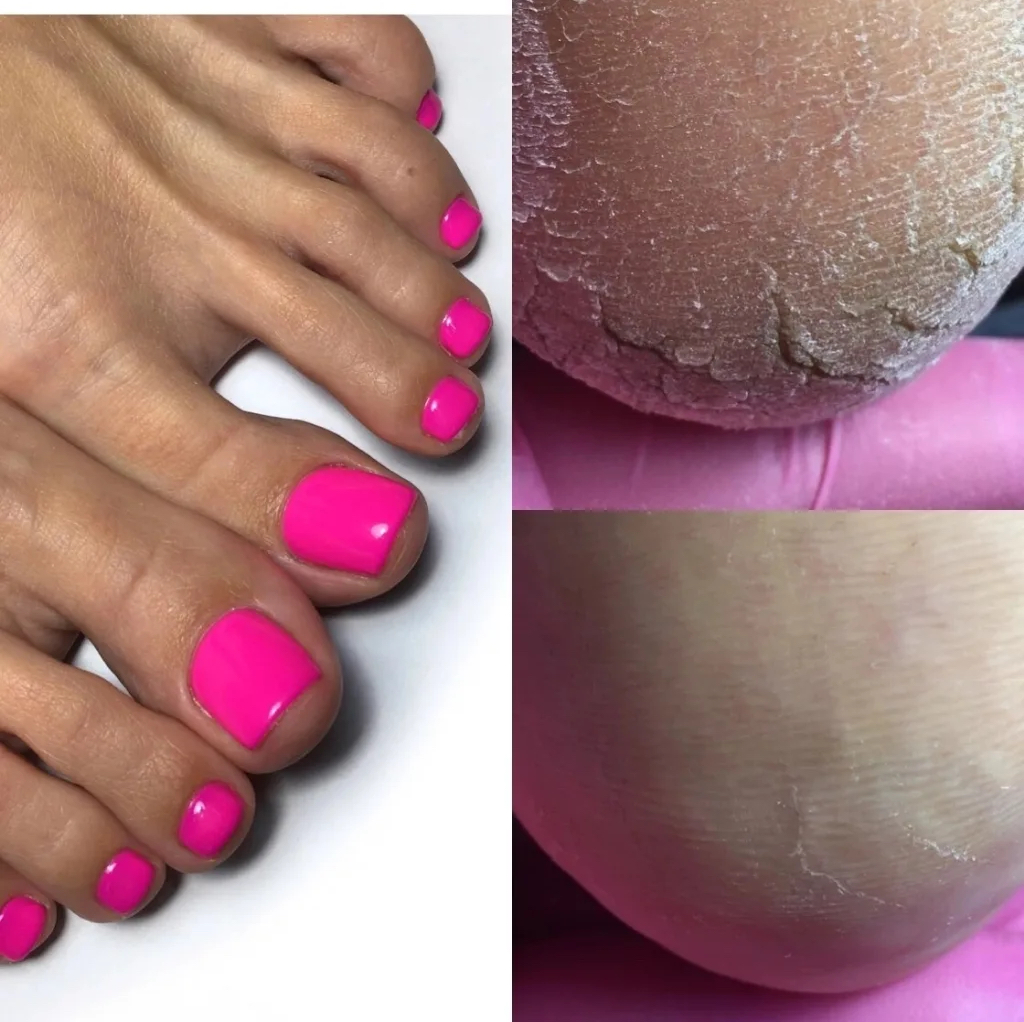 Полный педикюр с покрытием гель лак