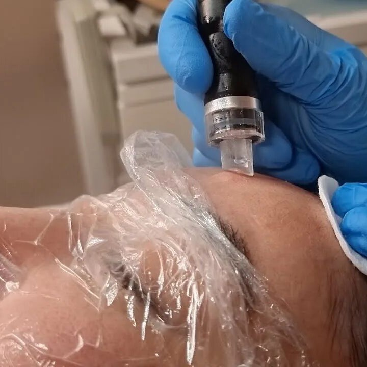 Гидропилинг + ультразвуковая чистка + альгинатная маска