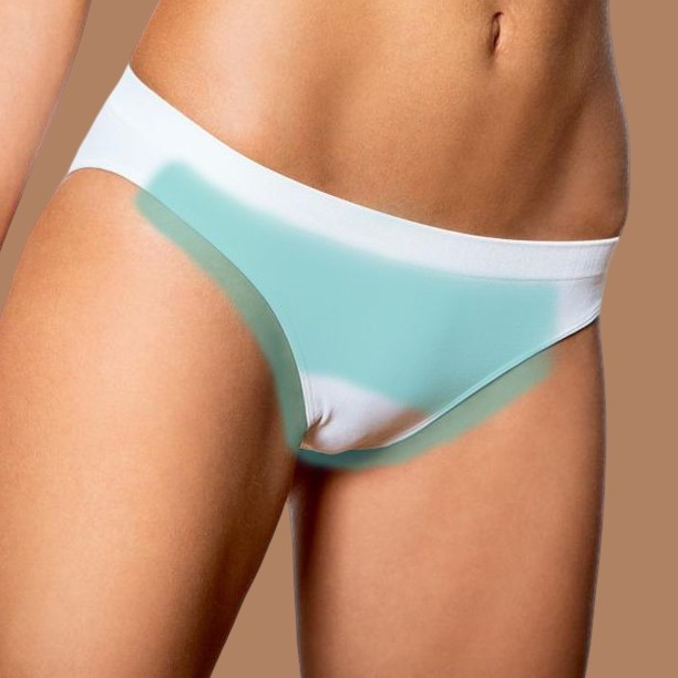 Бикини глубокое (без межъягодичной зоны)