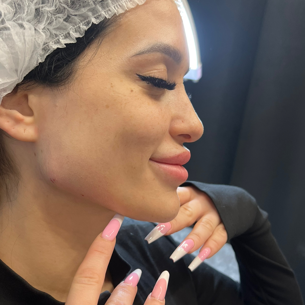 Углы Джоли ( углы нижней челюсти )