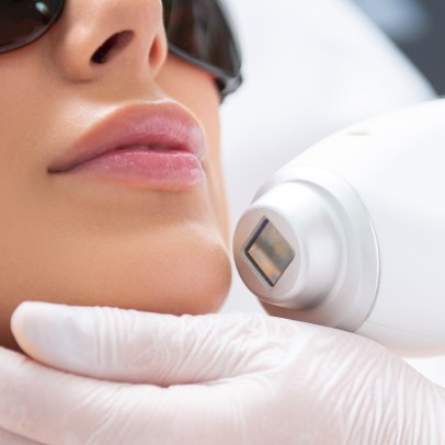 Абонемент на 8 сеансов: Лазерное омоложение лица